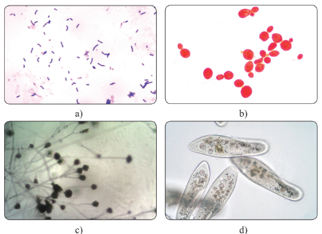 Hình thái vi sinh vật dưới kính hiển vi: vi khuẩn Bacillus subtilis (a) nấm men Saccharomyces cerevisiae (b) (phóng đại 1000 lần), nấm mốc Aspergillus niger (c) (phóng đại 100 lần) và trùng giày Paramecium caudatum (d) (phóng đại 400 lần)